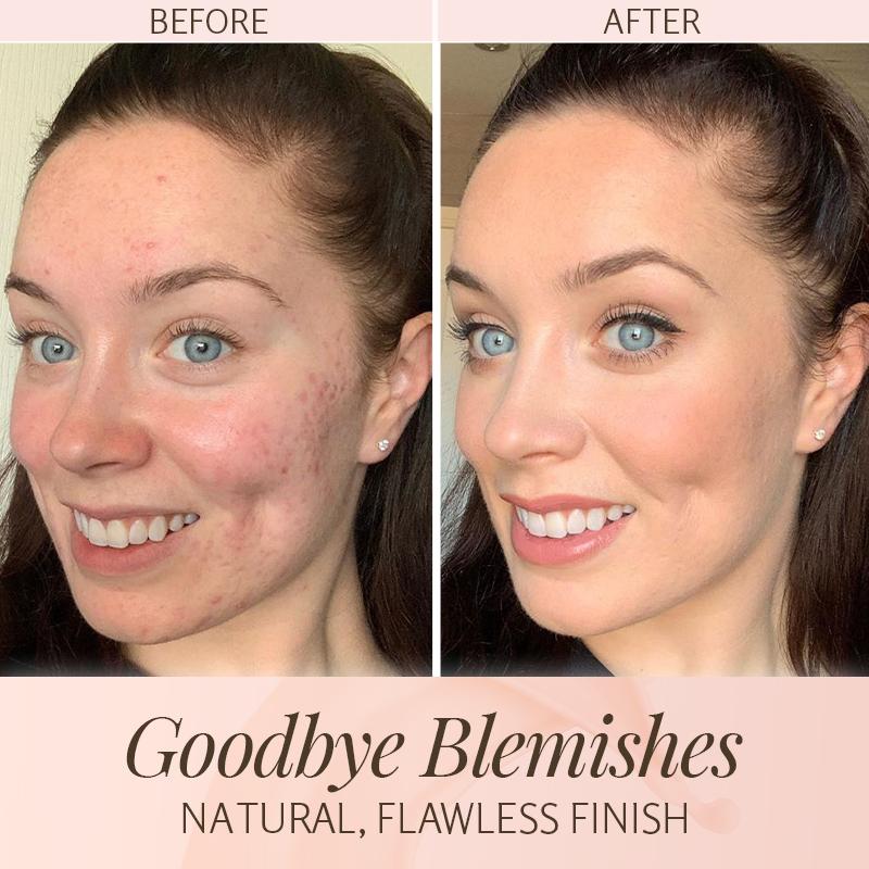 ByeBlemish Coverage Foundation