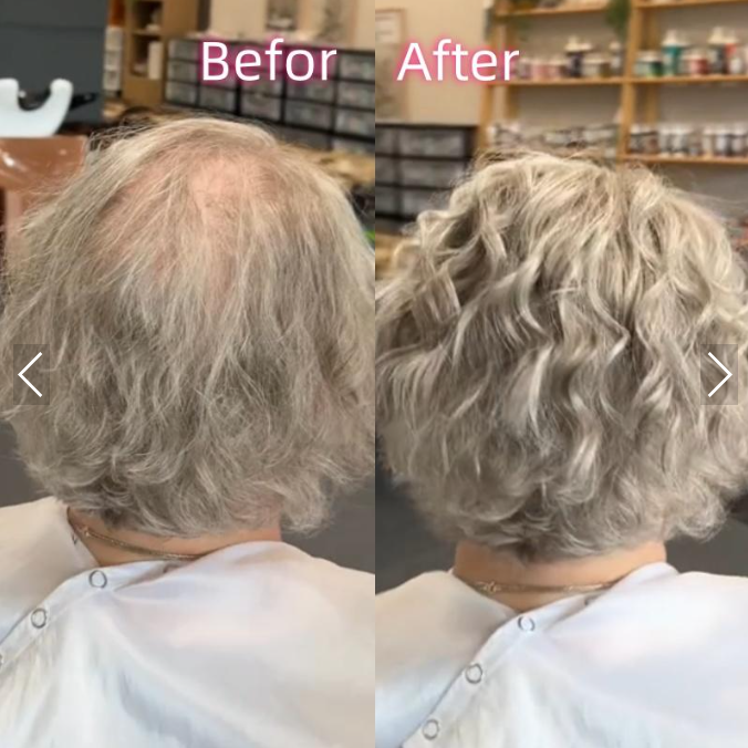 Hot Sale Fashion Curly Hair Toppers for Women with Thinning Hair